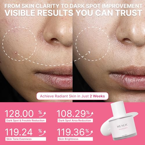 Toning Active Ampoule?Brightening, Hydrating&Soothing with Tranexamic Acid, Niacinamide&Hyaluronic Acid, Dark Spot Correction, Gentle for Sensitive Skin, Korean Skin Care, 50ml/1.69 fl.oz