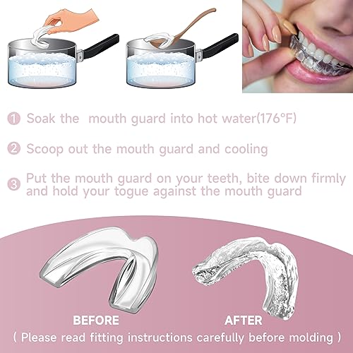 4 Pack Pink Mouth Guards for Women and Teens, Medium Size, Moldable Night Guards for Teeth Grinding and Clenching, Comfortable Bite Guards, Stylish Custom Dental Guards for Protection