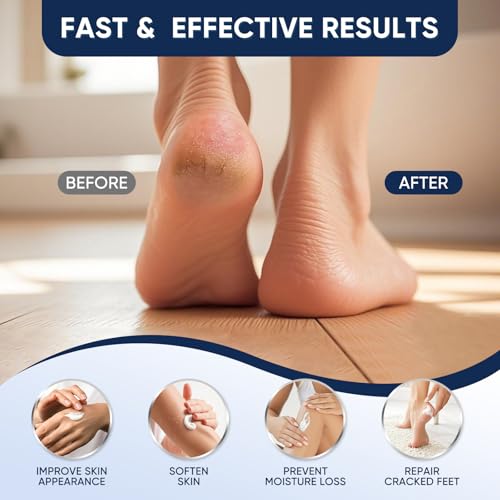 Urea Cream 40 Percent for Feet Maximum Strength, Urea Cream 40% Plus Salicylic Acid 2%, Foot & Hand Cream for Dry Cracked