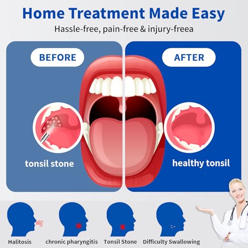 Tonsil Stone Remover with Camera£¬Tonsil Stone Removal Tool with LED Light£¬TonsilCleaner for Tonsil Stone Removal£¬Tonsillolith Removal Tool with 4 Head £¬Attachments for iOS & Android (Black and Gold)