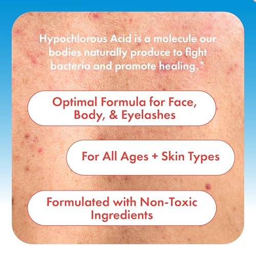 Hypochlorous Acid Spray for Face, Skin & Eyelids ? pH-Balanced HOCl Facial Spray Safe for Acne, Red & Sensitive Skin ? Gentle Non-Toxic Toner & Cleanser Mist for Clear, Hydrated Skin, 8 oz