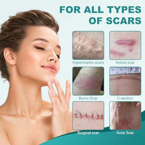 Silicone Scar Sheets, Silicone Scar Tape(1.6"x 158"), Scar Tape for Scar Removal Treatment, Reusable Silicone Scar Strips for Surgical, C-Section, Keloid, Burn, Acne, Surgical Scars