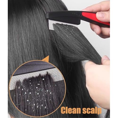 Dandruff Comb Fine Tooth Scalp Detox Comb Lice for Women, Men & Kids Stainless Steel Scalp Detoxing, Sweep & Massage Hair Brush Tool for Hair Care (Brown+Red)