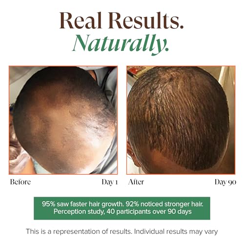 Kreyol Essence - Haitian Black Castor Oil for Skin and Hair, Glass Bottle | Cold Pressed | Hexane Free | Fuller-Looking Hair