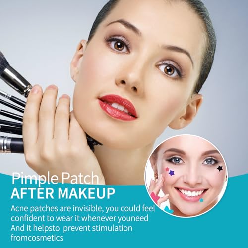 Pimple Patches for Face (648 Count),3 shapes (Round,Star and heart Shapes),Hydrocolloid Spot Dots with Salicylic Acid and Tea Tree Oil