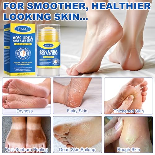 60% Urea Foot Cream for Cracked Heels, Maximum Strength 2% Salicylic Acid, Fast Absorbing, Intensive Moisturizing Foot Repair for Dry, Rough Skin & Callus Remover for Feet, 1.41 Oz