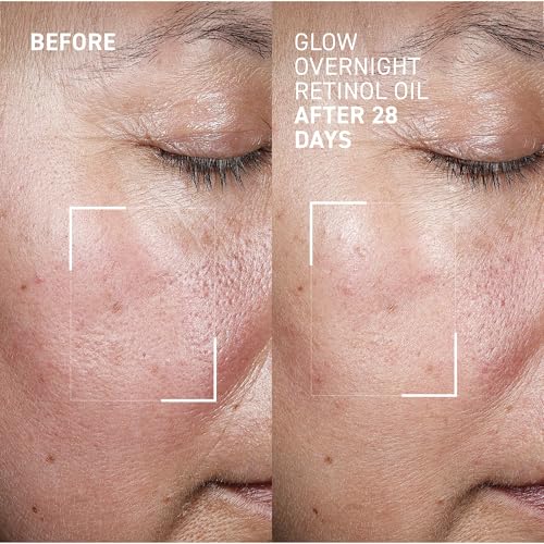 Dr. Brandt Bright This Way Glow Overnight Retinol Oil - Pure 2% Retinol Improves Wrinkles, Lines & Skin Texture - 1 fl oz