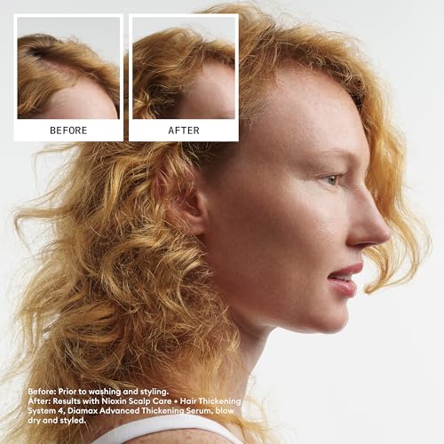 Nioxin Scalp + Hair Thickening System Kits | For Natural, Colored, & Damaged Hair with Light to Progressed Thinning | Strengthen & Boost Hair Density with Niacinamide & Biotin | 1 Month Supply