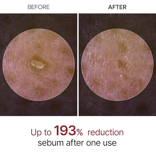 Dr.Melaxin Peel Shot Glow Black Rice Peeling Ampoule 80ml Daily Soft Exfoliating Face and Body Scrub Dead Skin Cells Remover for All Skin Types korean skin care