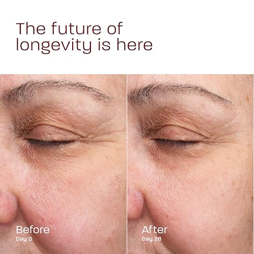 Morphiya Genesis Formula Concentrate ? All-in-One Collagen Booster with Bio-Engineered Exosomes for Age-Reversal & Firming, 1 fl oz