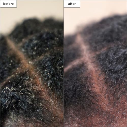 Briogeo Scalp Revival Charcoal + Tea Tree Scalp Treatment, Scalp Serum to Soothe a Dry, Flaky, Itchy Scalp, Absorb Oil, Hydrate Dry Scalp, Clarify Build Up, Vegan, Cruelty-Free, 1 fl oz