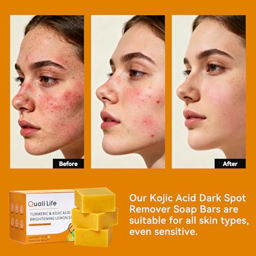Turmeric Soap For Dark Spot - Kojic Acid Soap Bar with Vitamin C for Face & Body, Natural Ingredients Handmade Soaps for Brightening & Moisturizing, 3 Bars