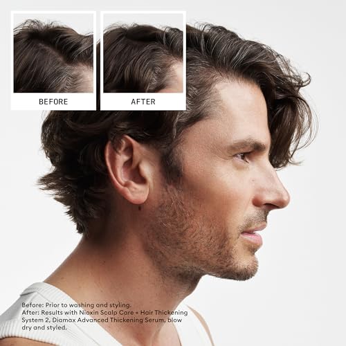 Nioxin System 2 Scalp + Hair Thickening Shampoo for Natural Hair with Progressed Thinning | Cleanse & Boost Hair Density with Niacinamide & Biotin