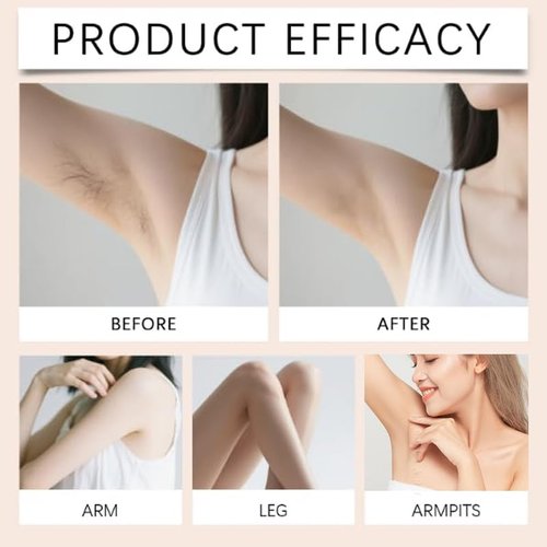 Hair Removal Cream, No Shave Hair Remover for Women, Fast and Gentle, Moisturizes and Nurtures Skin, Leaves Skin Smooth & Soft, 5.29 oz (1)