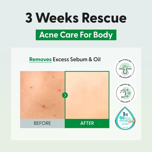 Saint Blanc Green Tea & Tea Tree Body Wash – For Acne-Prone Skin, with Centella & Heartleaf Extracts, Moisturizing, Hypoallergenic, Korean Skincare, 16.9 fl. oz