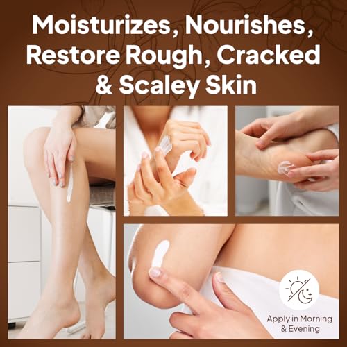 Pumice Valley Foot Cream for Dry Cracked Heels and Feet - Natural Moisturizer, Corn, Calluses Treatment - Skin, Body Lotion, Urea, Shea Butter, Jojoba Oil, Vitamin E 1.7 Oz