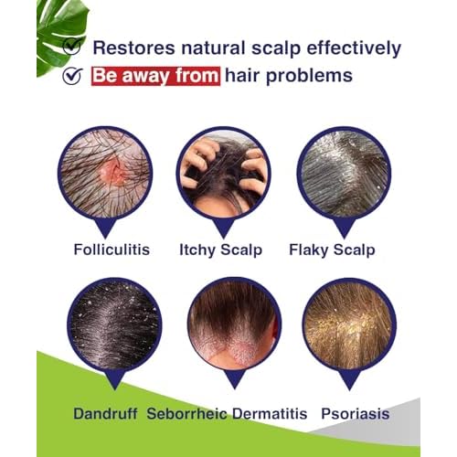 Anti-Fungal Shampoo for Folliculitis, Seborrheic Dermatitis, Scalp Psoriasis - Relieves Itchy & Dry Scalp
