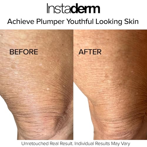 Crepe Fix Body Restorative Cream ? Anti-Aging Wrinkle Cream, Support Skins Natural Elastin & Collagen Production to Restore, Lift, Tighten, Hydrate & Smooth Thinning Aged Crepey Skin. 8OZ