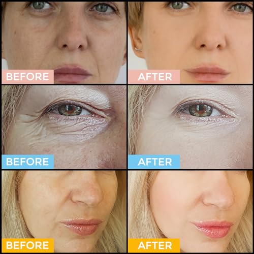 Facial Skin Care Set? Retinol Serum, Vitamin C & Hyaluronic Acid for Face ? Anti Aging Face Serum Set for Women ? Firm, Wrinkle Smoothing, Dark Spot Corrector, Brighten Dullness