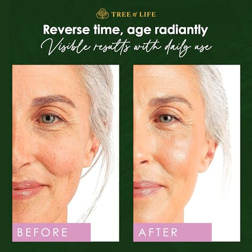 Tree of Life Beauty Retinol Serum, Skin Smoothing Face Oil for Dark and Age Spots and Fine Lines, Facial Serums for Dry and Sensitive Skin Care with Hyaluronic Acid for Soft Skin, 2 Fl Oz (pack of 2)