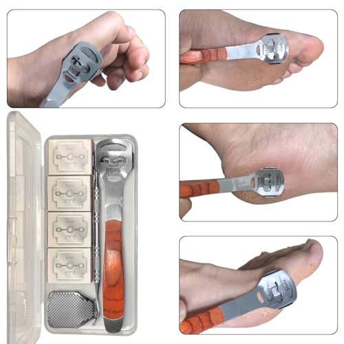 43 Pcs Callus Shaver for Feet Set, Foot Callus Shaver, (1 Stainless Foot File &1 Foot File Heads & 40 Replacement Slices Blades & 1 Nail Cleaning)