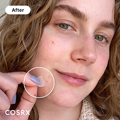 COSRX Acne Pimple Patch Absorbing Hydrocolloid Original 3 Size Patches for Blemishes and Zits Cover, Spot Stickers for Face and Body, Stocking Stuffers, Holiday Gifts, Gifts For Women (72)
