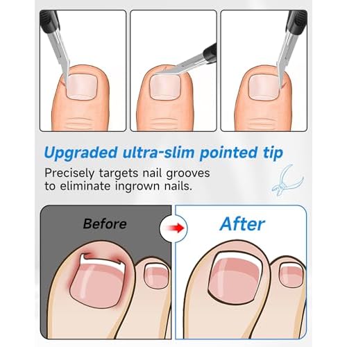 Nail Clippers,Toenail Clipper for Ingrown or Thick Toe Nails,Fingernail Clipper for Men Women Seniors with Stainless Steel Straight Blade Soft Handle Nail Cutter Black