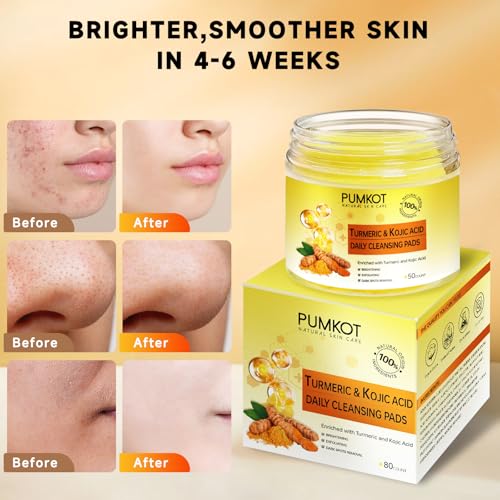 Turmeric Kojic Acid Cleansing Pads, Turmeric Face Scrub Pads Enriched with Kojic Acid, 80PCS