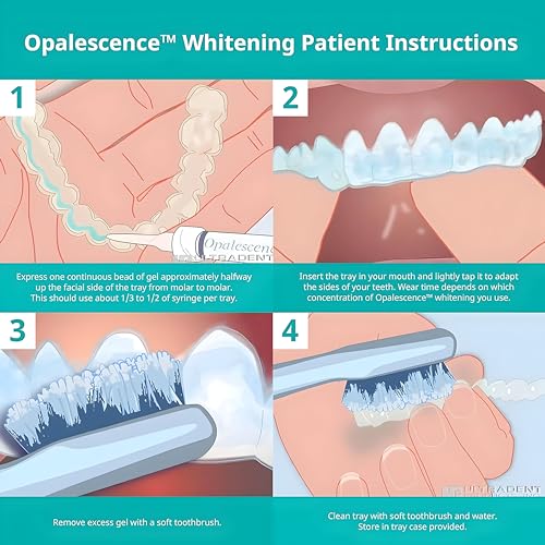Opalescence 20% Gel Syringes Teeth Whitening - Refill Kit (12 Syringes) Carbamide Peroxide. Made by Ultradent, in Mint Flavor. Tooth Whitening - B-5196-6