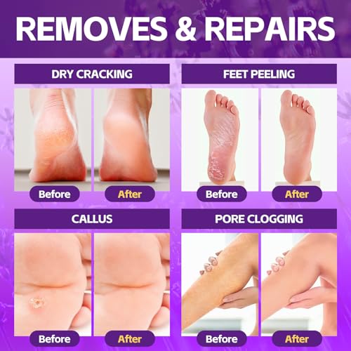 Pedicure Foot Soak, Foot Spa Soak, Pedicure Kit, Bubble Foot Bath For Tired & Dry Cracked Feet, Athletes Feet, Odor Foot and Softens Calluses, Foot Soak 16 Packs A Box, Lavender