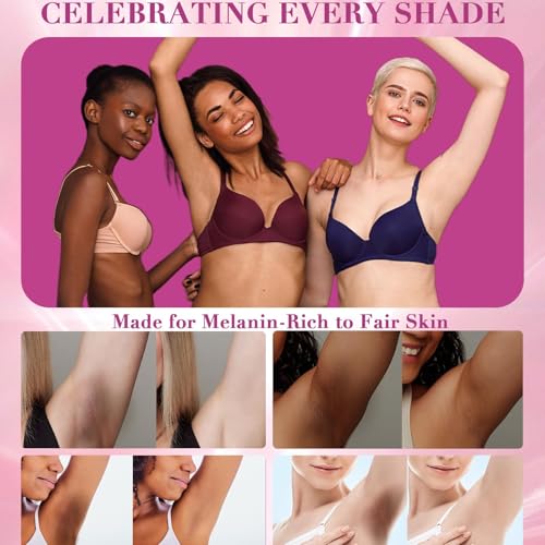 Skin Lightening Cream, Dark Spots Remover for Body Even Toning, Effectively Whitening Women Intimate Areas, Bikini Line, Underarms, Knees, Elbows, Renew Complexion and Replenish Skin Barrier