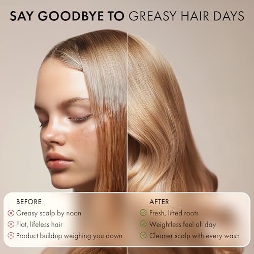Chelating Shampoo ? For Oily Hair & Oily Scalp -Deep Cleansing Clarifying Shampoo- Removes Hard Water Buildup, Chlorine & Residue-Nourishes-No Silicones, No Parabens, Fresh Volume. 12 Fl Oz ( 355 ML)
