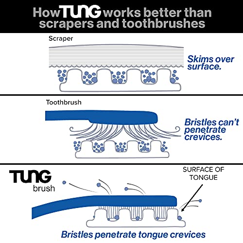 Tung Brush Tongue Cleaner, Plastic Tung Scraper, Tongue Cleaning to Fight Bad Breath, Halitosis Defense, USA Made, 2-Pack w/Cap