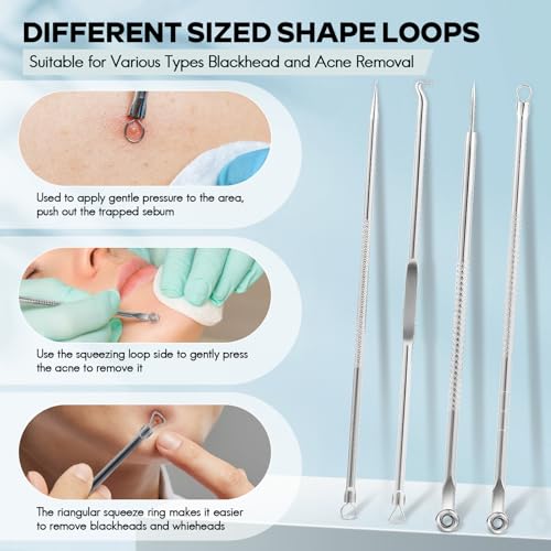 FEITA Blackhead Remover Pimple Popper Tool Kit, Comedone Pimple Extractor Acne Tools for Face Nose, Stainless Acne Needle Zit Popping Removal Facials Tool, Silver 4Pcs