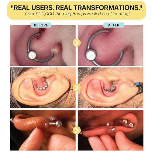 BASE LABORATORIES Keloid Bump Removal Gel | Natural Piercing Bump Treatment & Keloid Scar Gel | Keloid Scar Removal for all Scars, Keloids & Piercing Bumps | Soothing Piercing Aftercare | 2 oz