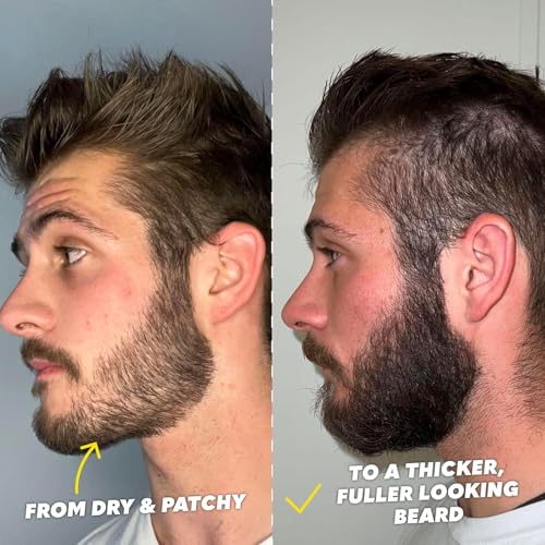 The Beard Club Ultimate Beard Growth Kit - Derma Roller, Growth Oil, Vitamins, Vitamin Spray, Biotin Balm, Conditioner, Cream, Balms, Shampoo, Razor, Scissors, Combs, Brush, Cleansing Spray - Gift Set