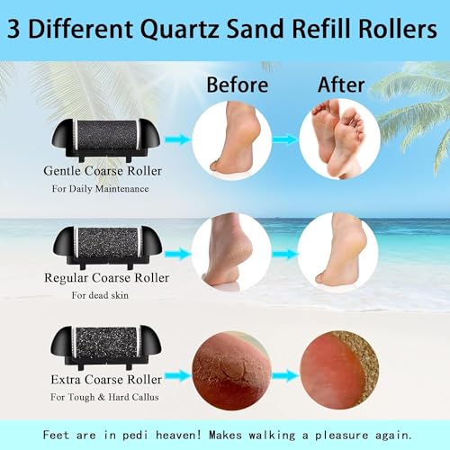 Extra Coarse 3 Refill Rollers for Electric Feet Callus Remover BK-506, Replacement Rollers Heads Foot Care Pedicure Tools 3 Pack- 1 Extra Coarse, 1 Regular Coarse, 1 Gentle Coarse Refill Rollers