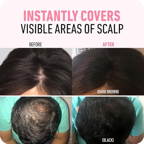 Instant Hair Powder, Hair Powder for Women and Men, Fills in Hairline, Easy to Apply and Color(Dark Brown)