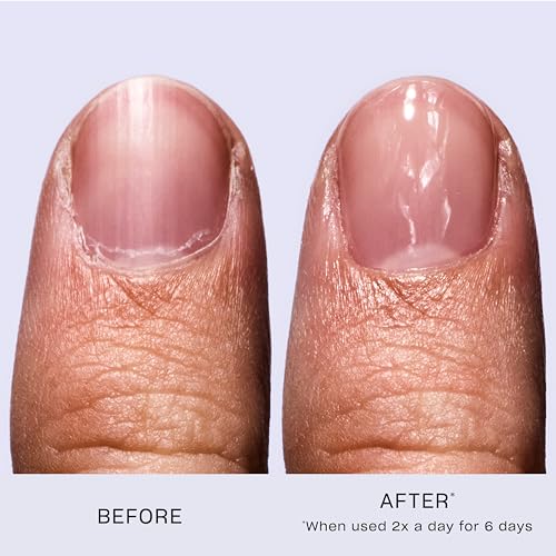 OPI Nail Envy Nail Strengthener | Clear & Opaque Cr?me Nail Polish Treatment | Strengthen Weak & Thin Nails
