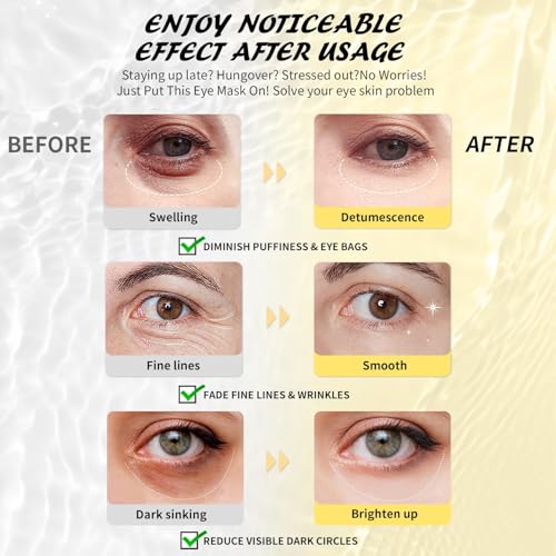 Under Eye Patches(50 Pairs), 24K Gold, Caffeine, Hyaluronic Acid, Aloe Vera Eye Masks for Dark Circles Puffy Eyes Undereye Bags, Eye Skin Care Gift Set for Bachelorette Party Favors