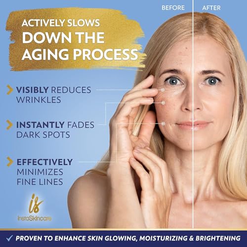 Niacinamide Serum 8Oz for Face 10% with Zinc 1% Vitamin B3 Brightening Serum for Tone, Texture