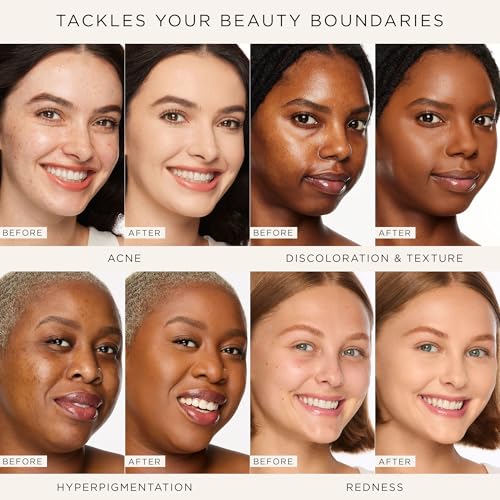 tarte shape tape concealer ? Full-Coverage, Matte Finish for Under Eye, Dark Circles, Fine Lines, Redness & Discoloration, Longwear, Dermatologist-Tested, Vegan, Cruelty-Free