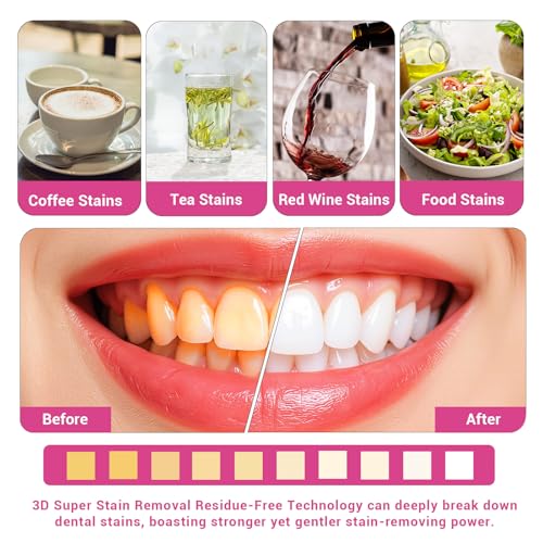 CALLSMILE Teeth Whitening Strips Kit 32 Treatments - Whitening Strips for Sensitive People, Fast Remove Smoking, Coffee, Wine Stains, White Strips for Teeth Whitening (64 Strips)