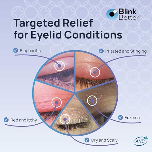 BetterLids Eyelid Ointment ? Intense Oat Complex with Shea Butter & Panthenol - Hydrates, Nourishes & Soothes ? Moisturizing Care for Dry, Itchy, Red, Sensitive, Flaky Skin Around the Eyes - 0.35 oz
