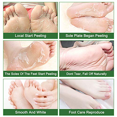 Lily Beauty Foot Mask