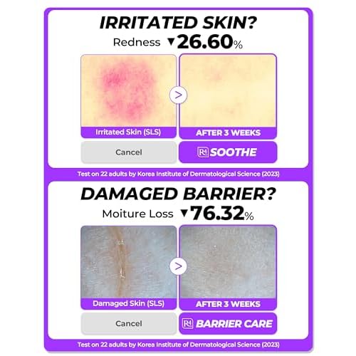Dermafirm Soothing Repair Korean Emulsion Cream R4 | Daily Face Moisturizer Skin Care Emulsion with Eucalyptus, Peptide and Collagen | Gentle for All Skin Types No Animal Trials No Paraben 6.76 fl oz