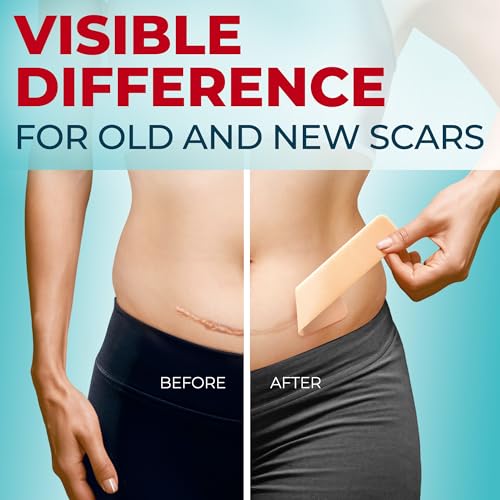 Medical Grade Silicone Scar Sheets - 6pk (5.7¡±x1.6¡±) - Visible Difference on Surgical & Keloid Marks - Reusable C-Section Scar Silicone Strips - Easy to Use Strips