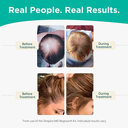 Shapiro MD Hair Growth Experts Hair Loss Shampoo and Conditioner, DHT Fighting Vegan Formula for Thinning Hair Developed by Dermatologists, Experience Healthier & Thicker Hair - 2 Month Supply