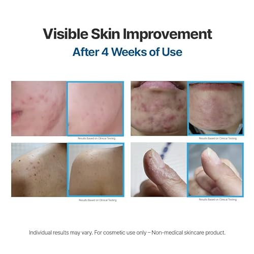 PRO-RESOLVING CREAM