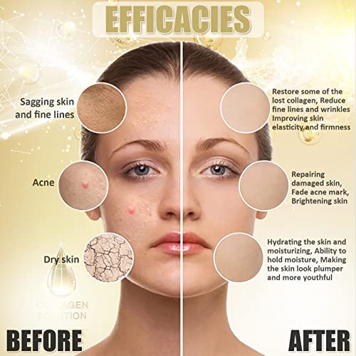 YMEYFAN Jelly Mask for Facials Professional, Collagen Peel Off Jelly Face Mask Powder, Deep Hydrating Moisturizing Facial Skin Care, Home Spa Day DIY Skincare for Women and Men (23Fl Oz)
